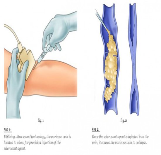 Interventional Radiology Equipment